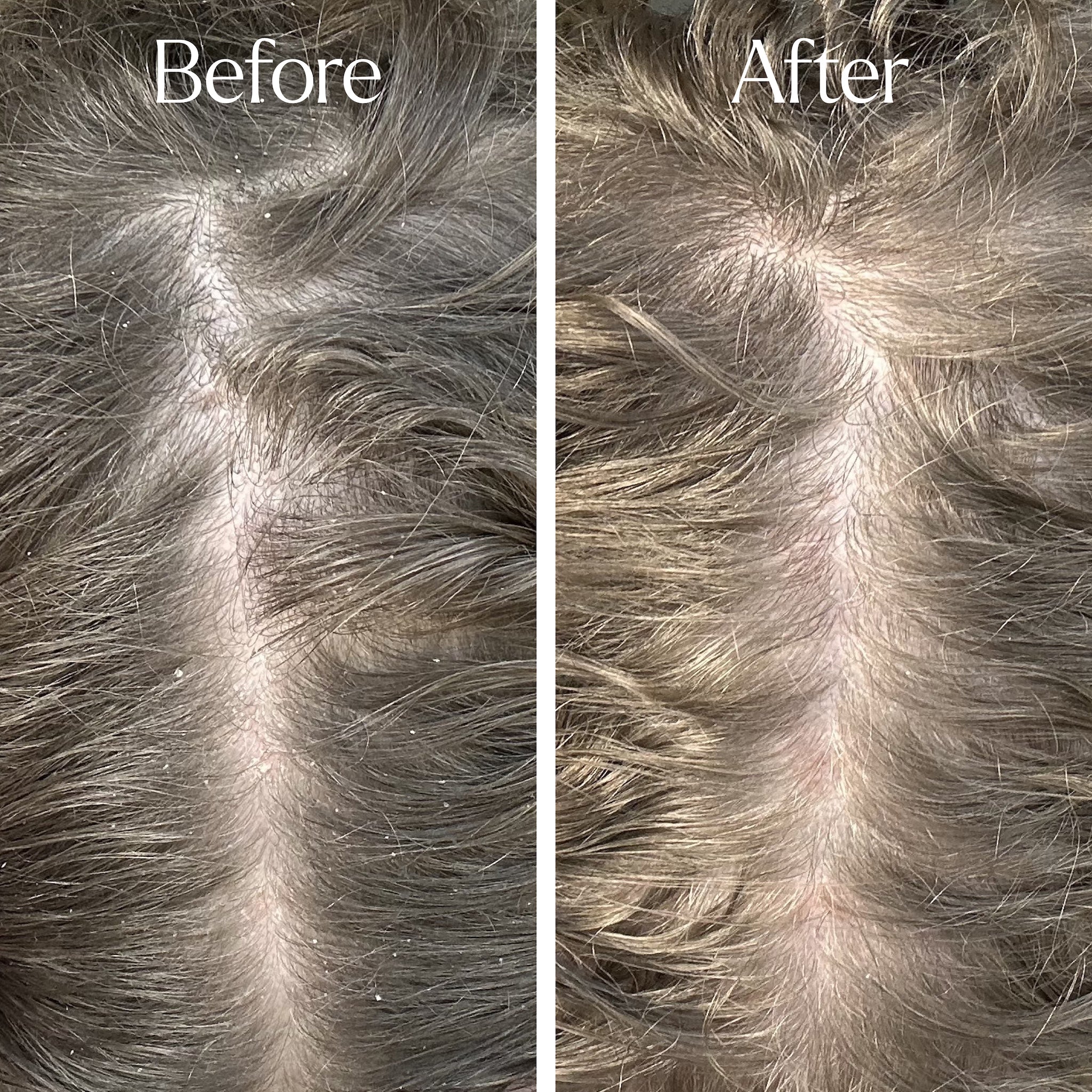 Only Curls Curl Detox Clarifying Shampoo - Image 4